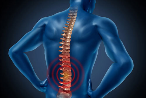 Spondylitis Treatment in Homeopathy