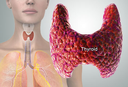 Thyroid Treatment in Homeopathy