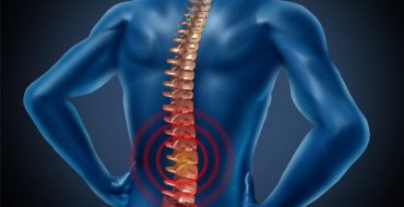 homeopathy Spondylitis treatment