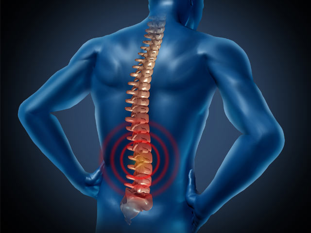 homeopathy Spondylitis treatment