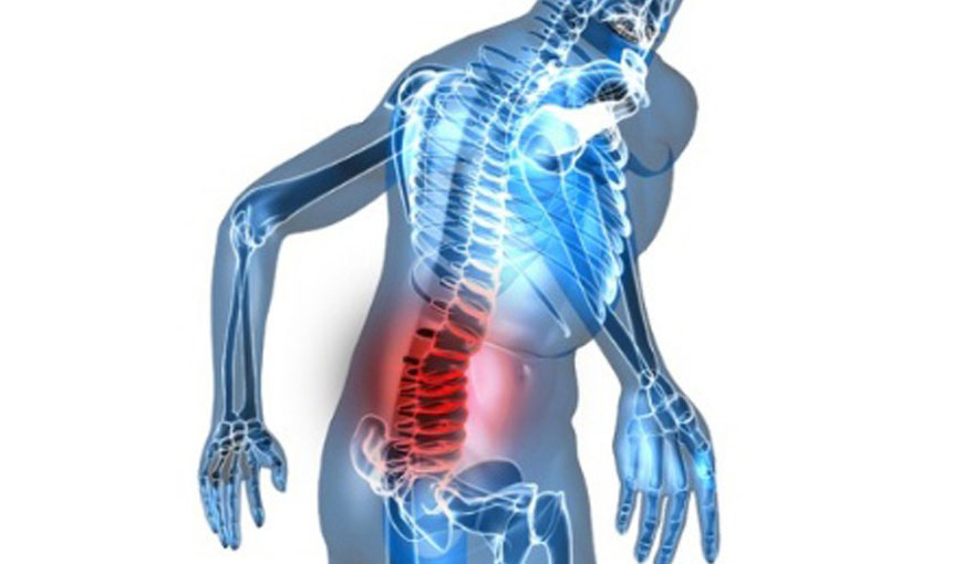 Spondylitis Treatment in Homeopathy