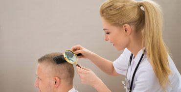 homeopathy hair loss treatment in hyderabad