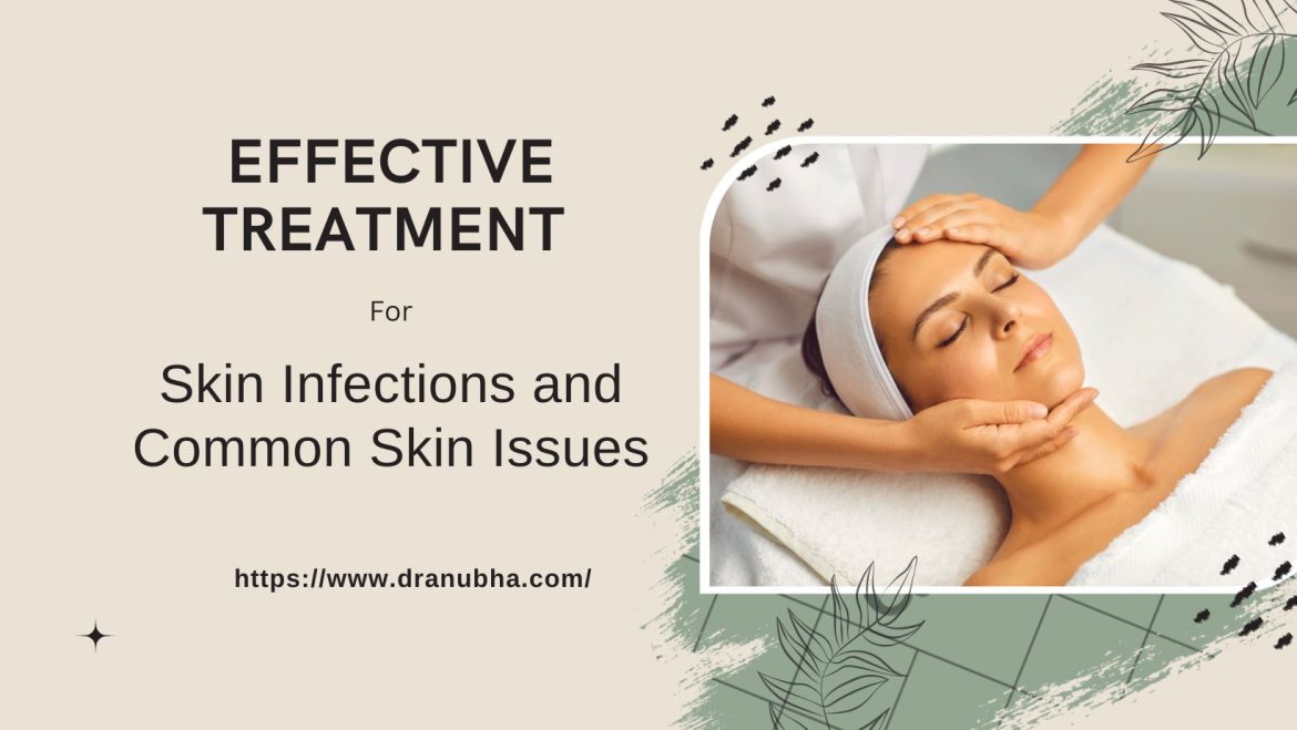 Effective Treatment for Skin Infections and Common Skin Issues