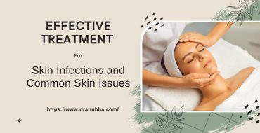 Effective Treatment for Skin Infections and Common Skin Issues