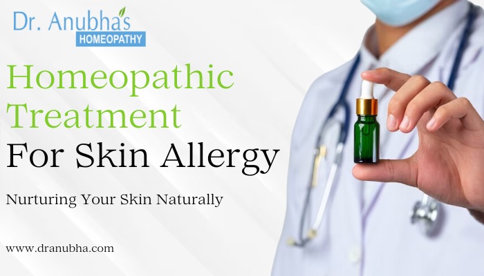 Homeopathy Treatment for Skin Allergy: